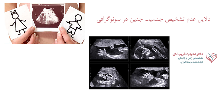 دلایل عدم تشخیص جنسیت جنین در سونوگرافی