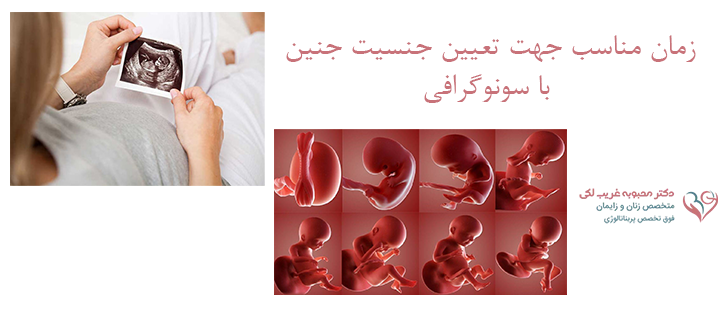 زمان مناسب جهت تعیین جنسیت جنین با سونوگرافی
