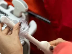 سونوگرافی واژینال