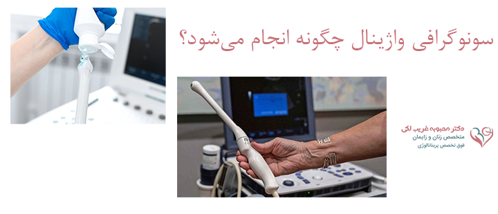 سونوگرافی واژینال چگونه انجام می‌شود؟