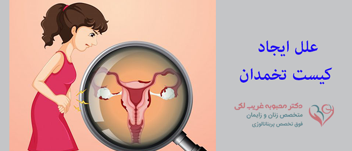 علت های ایجاد کیست تخمدان 