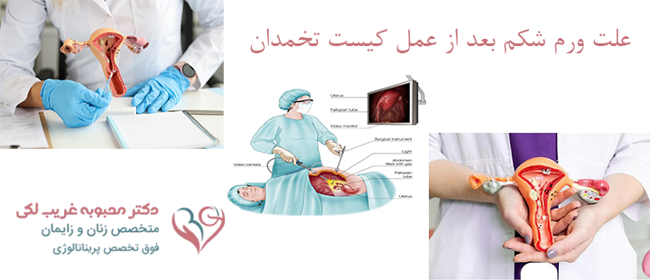 علت ورم شکم بعد از عمل کیست تخمدان 