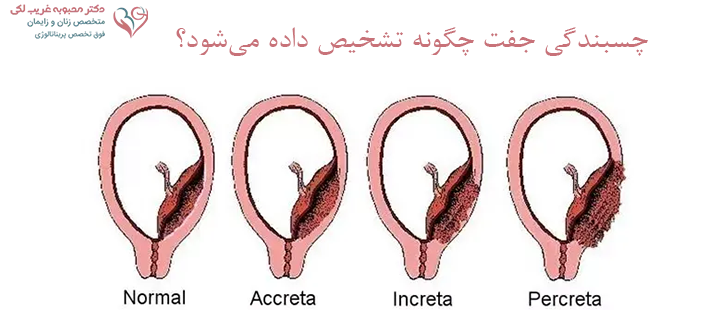 چسبندگی جفت چگونه تشخیص داده می‌شود؟