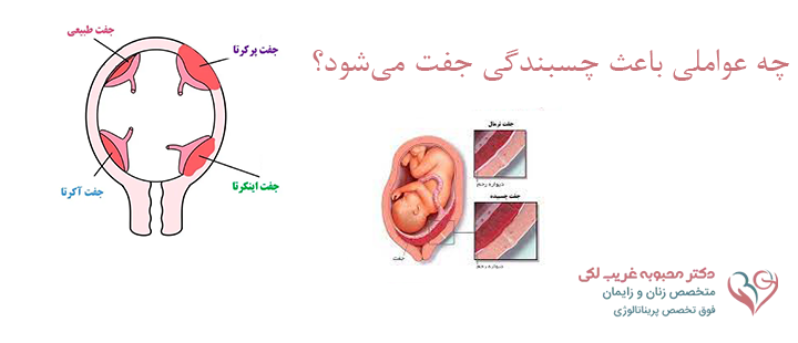 چه عواملی باعث چسبندگی جفت می‌شود؟